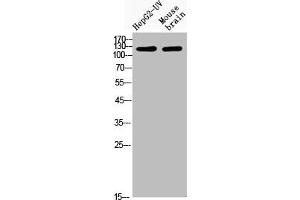 Western Blot analysis of HepG2-UVmouse brain cells using Acetyl-CRM1 (K568) Polyclonal Antibody (XPO1 anticorps  (acLys568))