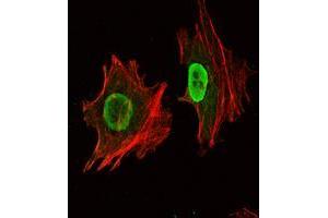 Immunofluorescence analysis of NTERA-2 cells using Oct4 mouse mAb (green). (OCT4 anticorps)
