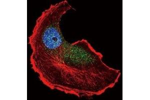 Confocal immunofluorescent analysis of phospho-TSC2 antibody with MCF-7 cells followed by Alexa Fluor 488-conjugated goat anti-rabbit lgG (green).