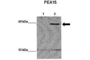 WB Suggested Anti-PEA15 Antibody    Positive Control:  Lane 1: 20ug EGFP-transfected MCF7 lysate Lane 2: 20ug EGFP-PEA15 transfected MCF7 lysate   Primary Antibody Dilution :   1:1000  Secondary Antibody :  Goat anti-rabbit-HRP   Secondry Antibody Dilution :   1:5000  Submitted by:  Yann Wallez (Sanford-Burnham Medical Research Institute)