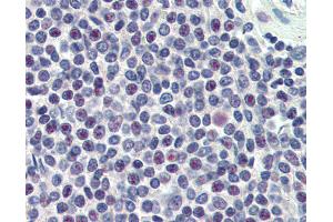 Anti-HMG20A antibody IHC of human spleen. (HMG20A anticorps  (AA 336-347))