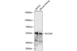 Western blot analysis of extracts of various cell lines, using SLC2 antibody (ABIN7270416) at 1:1000 dilution. (SLC2A9 anticorps  (AA 400-500))