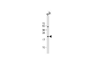 Anti-VHL Antibody (C-term) at 1:1000 dilution + Raji whole cell lysate Lysates/proteins at 20 μg per lane.