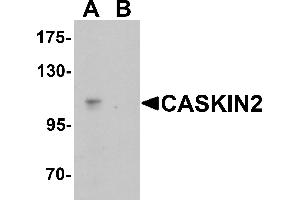 Western blot analysis of CASKIN2 in Hela cell lysate with CASKIN2 antibody at 1 µg/mL in (A) the absence and (B) the presence of blocking peptide.