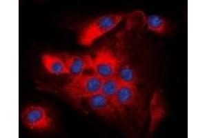 Immunofluorescent analysis of BCL2 (pT56) staining in A549 cells. (Bcl-2 anticorps  (pSer56))
