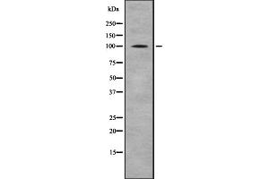 Western blot analysis of CTNNA1/CTNNA2 using HeLa whole cell lysates (CTNNA2 anticorps  (C-Term))