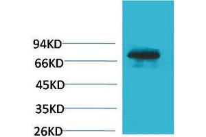 Western Blotting (WB) image for anti-Transferrin (TF) antibody (ABIN3181544)