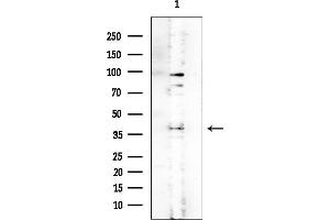 anti-Glucosamine-6-Phosphate Deaminase 1 (GNPDA1) (C-Term) antibody