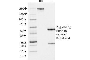 SDS-PAGE Analysis Purified gp100 Mouse Monoclonal Antibody (PMEL/2037).
