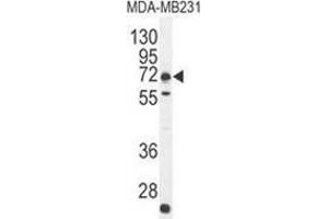Western blot analysis in MDA-MB231 cell line lysates (35ug/lane) using C18orf8/MIC1 Antibody (N-term). (C18orf8 anticorps  (N-Term))