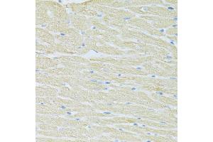 Immunohistochemistry of paraffin-embedded rat heart using SLC40A1 antibody (ABIN6292414) at dilution of 1:100 (40x lens). (SLC40A1 anticorps)