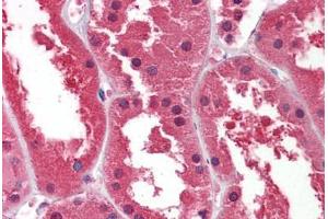 Human Kidney: Formalin-Fixed, Paraffin-Embedded (FFPE)