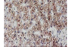 Immunohistochemical staining of paraffin-embedded Human liver tissue using anti-EXOSC7 mouse monoclonal antibody. (EXOSC7 anticorps)