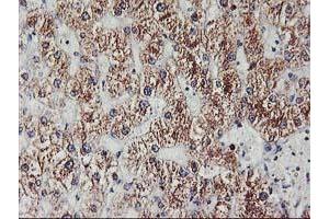 Immunohistochemical staining of paraffin-embedded Human liver tissue using anti-EXOSC7 mouse monoclonal antibody. (EXOSC7 anticorps)