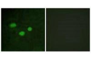 Immunofluorescence analysis of HeLa cells, using DNMT3B antibody. (DNMT3B anticorps  (N-Term))