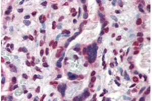 Human Placenta (formalin-fixed, paraffin-embedded) stained with ATF6 antibody ABIN337286 at 10 ug/ml followed by biotinylated anti-mouse IgG secondary antibody ABIN481714, alkaline phosphatase-streptavidin and chromogen. (ATF6 anticorps  (AA 1-273))