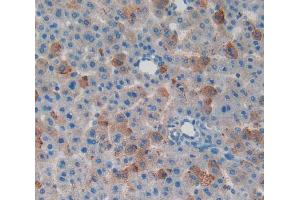 IHC-P analysis of liver tissue, with DAB staining. (MYO1F anticorps  (AA 655-922))