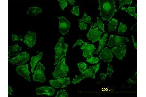anti-rho-Associated, Coiled-Coil Containing Protein Kinase 1 (ROCK1) (AA 401-510) antibody