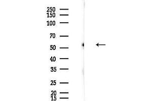 anti-ERO1-Like beta (ERO1LB) (Internal Region) antibody