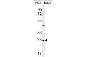 EDN3 Antibody (C-term) (ABIN655169 and ABIN2837855) western blot analysis in NCI- cell line lysates (35 μg/lane).