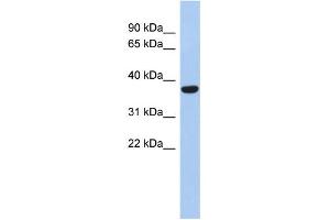 WB Suggested Anti-PPAPDC2 Antibody Titration: 0. (PPAPDC2 anticorps  (N-Term))