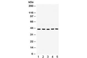 Western blot testing of 1) rat ovary, 2) rat testis, 3) mouse testis, 4) human 22RV1 and 5) human SKOV lysate with GNAQ antibody.