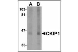 Western blot analysis of CKIP1 in human lung tissue lysate with CKIP1 antibody at (A) 1 and (B) 2 µg/ml. (PLEKHO1 anticorps  (C-Term))