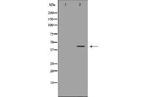 Western blot analysis of Hepg2 whole cell lysates, using NDRG2 Antibody. (NDRG2 anticorps  (C-Term))
