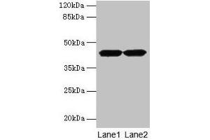 Western blot All lanes: ACTRT2 antibody at 6 μg/mL Lane 1: HepG2 whole cell lysate Lane 2: A431 whole cell lysate Secondary Goat polyclonal to rabbit IgG at 1/10000 dilution Predicted band size: 42 kDa Observed band size: 42 kDa (ACTRT2 anticorps  (AA 1-376))