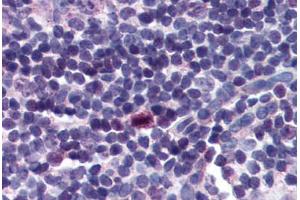 Human Tonsil (formalin-fixed, paraffin-embedded) stained with BIRC5 antibody ABIN214295 at 2. (Survivin anticorps  (C-Term))