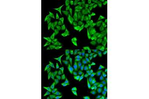 Immunofluorescence analysis of HeLa cells using PSMD9 antibody. (PSMD9 anticorps  (AA 1-223))