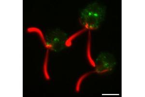 Immunofluorescence (IF) image for anti-Clathrin Heavy Chain (CLTC) antibody (ABIN7477856) (Clathrin Heavy Chain (CLTC) anticorps)
