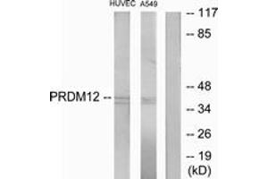 Western blot analysis of extracts from HuvEc/A549 cells, using PRDM12 Antibody. (PRDM12 anticorps  (AA 191-240))