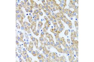 Immunohistochemistry of paraffin-embedded human liver injury using INADL antibody. (PATJ anticorps)