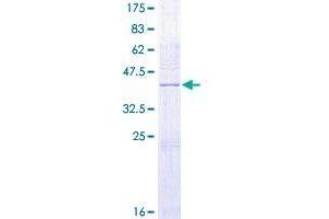 Image no. 1 for Dual Specificity Phosphatase 10 (DUSP10) (AA 1-140) protein (GST tag) (ABIN1352098)