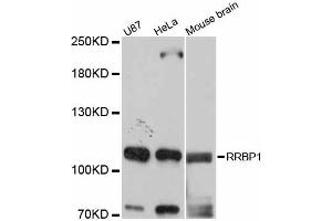 Western blot analysis of extracts of various cell lines, using RRBP1 antibody (ABIN6293720) at 1:3000 dilution. (RRBP1 anticorps)