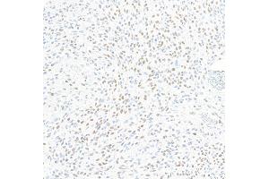 Immunohistochemistry (IHC) image for anti-Zinc Finger E-Box Binding Homeobox 1 (ZEB1) (AA 750-800) antibody (ABIN7455173) (Recombinant ZEB1 anticorps  (AA 750-800))