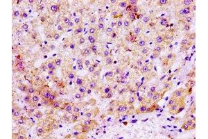 IHC image of ABIN7159722 diluted at 1:100 and staining in paraffin-embedded human liver tissue performed on a Leica BondTM system. (MGST1 anticorps  (AA 63-96))