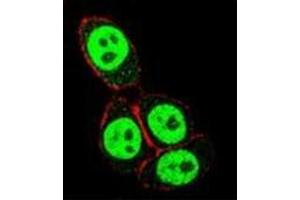 Confocal immunofluorescent analysis of SMAD3 Antibody  with Hela cell followed by Alexa Fluor 488-conjugated goat anti-rabbit lgG (green). (SMAD3 anticorps  (Ser208))