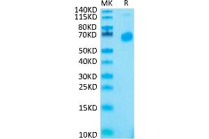 Human CD27 Ligand Trimer on Tris-Bis PAGE under reduced condition.