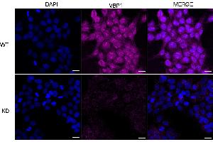 anti-Prefoldin Subunit 3 (PFDN3) antibody