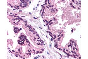 Anti-TGFB1I1 / HIC-5 antibody IHC of human prostate.