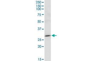 MAGEA8 MaxPab rabbit polyclonal antibody.