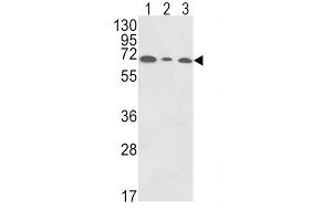 Western Blotting (WB) image for anti-Polymeric Immunoglobulin Receptor (PIGR) antibody (ABIN3003801) (PIGR anticorps)