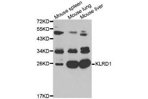 Western blot analysis of extracts of various cell lines, using KLRD1 antibody.