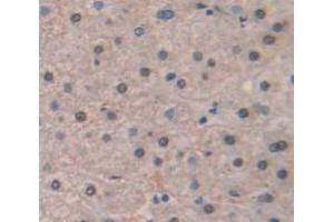 Figure. (HIST1H2AJ anticorps  (AA 1-128))