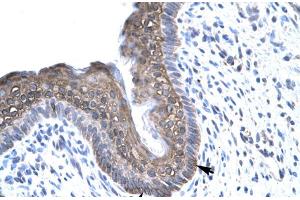Human Spermatophore (FOXE3 anticorps  (C-Term))