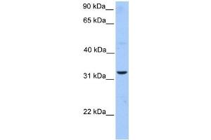 ATG5 antibody used at 1 ug/ml to detect target protein. (ATG5 anticorps)