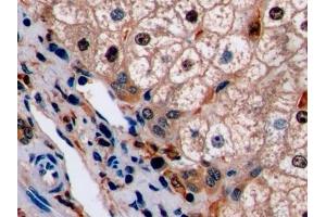 Detection of Ki-67 in Human Liver Tissue using Polyclonal Antibody to Ki-67 Protein (Ki-67)