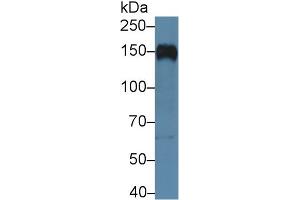 Western blot analysis of Human Raji cell lysate, using Human CR2 Antibody (5 µg/ml) and HRP-conjugated Goat Anti-Rabbit antibody ( (CD21 anticorps  (AA 729-957))